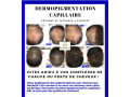 dermopigmentation-capillaire-pour-camoufler-votre-calvitie-small-1