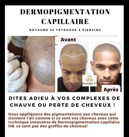 dermopigmentation-capillaire-pour-camoufler-votre-calvitie-big-0